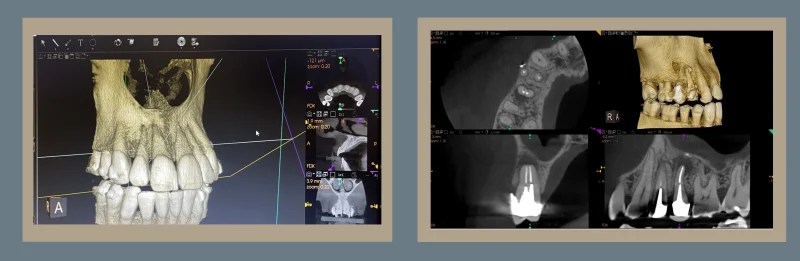 3D Imaging, Cone Beam CT