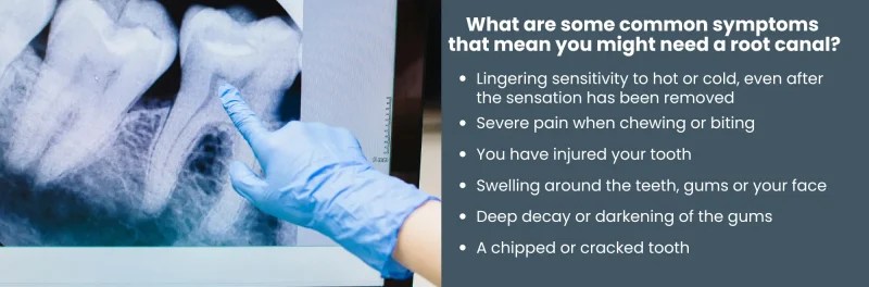 Endodontic FAQ