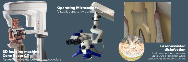 Endodontic FAQ