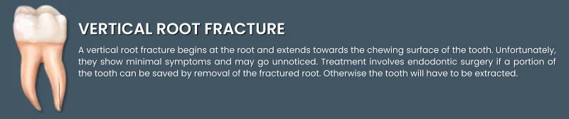 Treatment of Cracked Teeth illustration